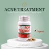 Acne Treatment