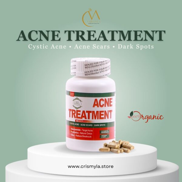 WhatsApp Image 2026-05-15 at 23.23.27 Acne Treatment