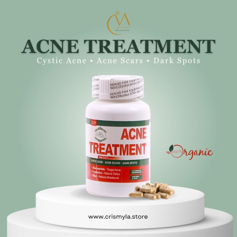 Acne Treatment