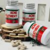 WhatsApp Image 2026-05-15 at 23.32.39 (1) Acne Treatment