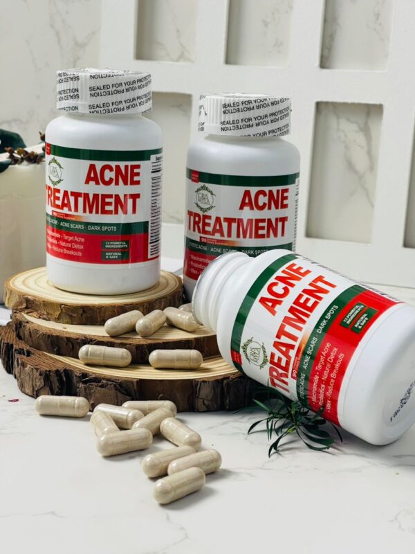 WhatsApp Image 2026-05-15 at 23.32.39 (1) Acne Treatment